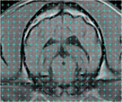 Effect of Skull Type on the Relative Size of Cerebral Cortex and Lateral Ventricles in Dogs